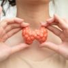 Hyperthyroidism, Overactive Thyroid, Thyroid Lymphoma, Asian woman with thyroid gland human anatomy model.