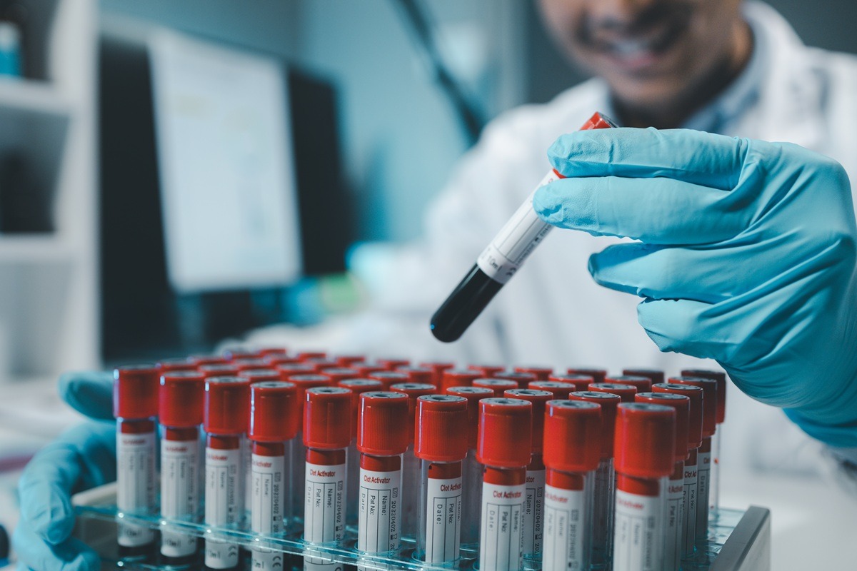 A chemist is using a microscope to search for chemicals from blood in a test tube. A chemist is using a microscope to search for chemicals from blood in a test tube.
